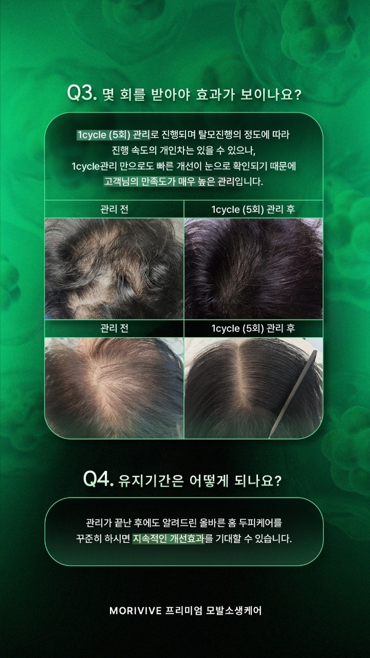 나를가꾸다 속눈썹&눈썹 photo 6