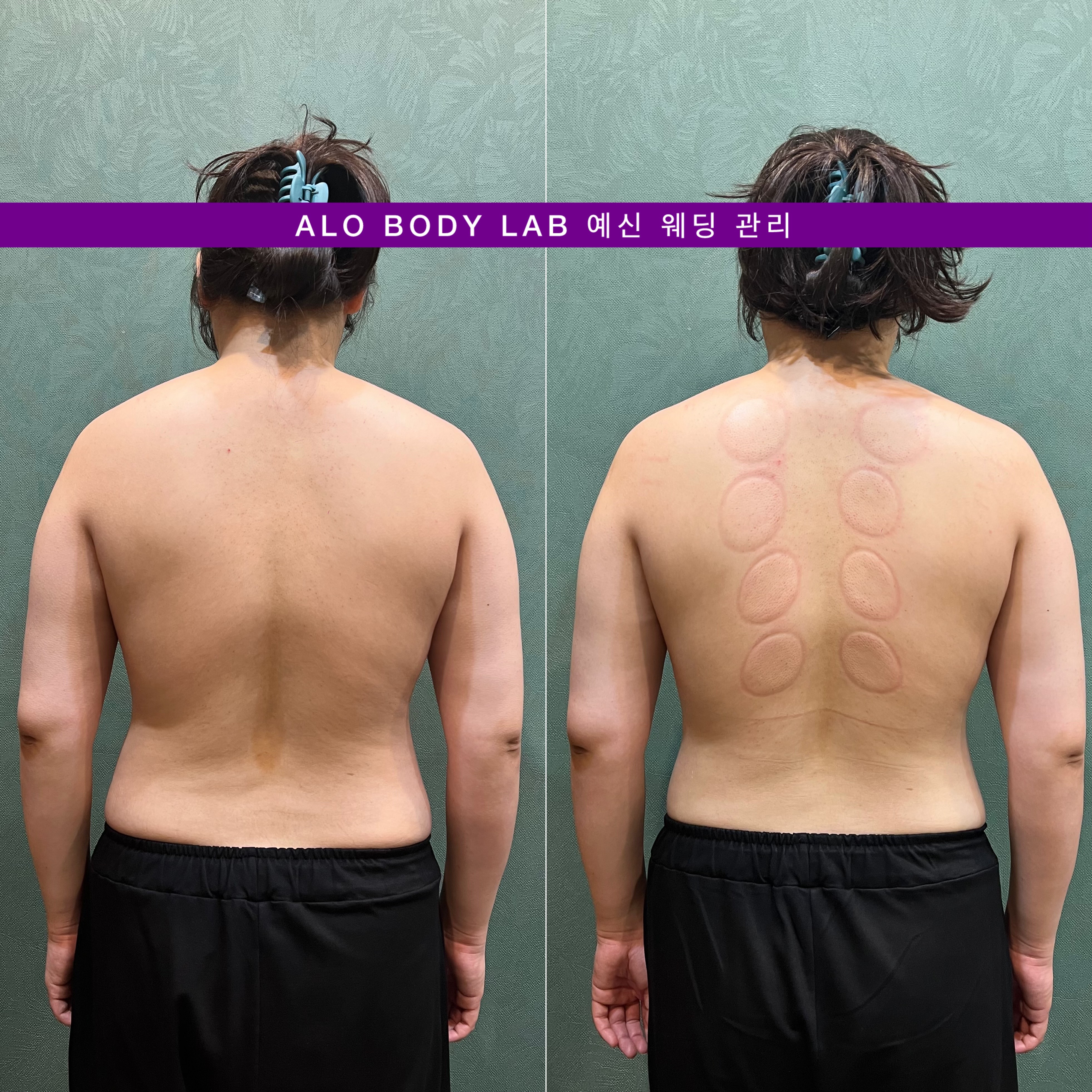 안중 마사지 알로바디랩 photo 7