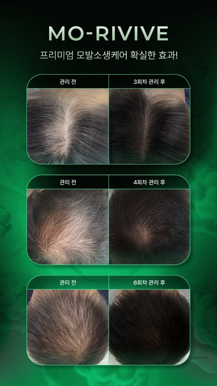 나를가꾸다 속눈썹&눈썹 photo 4