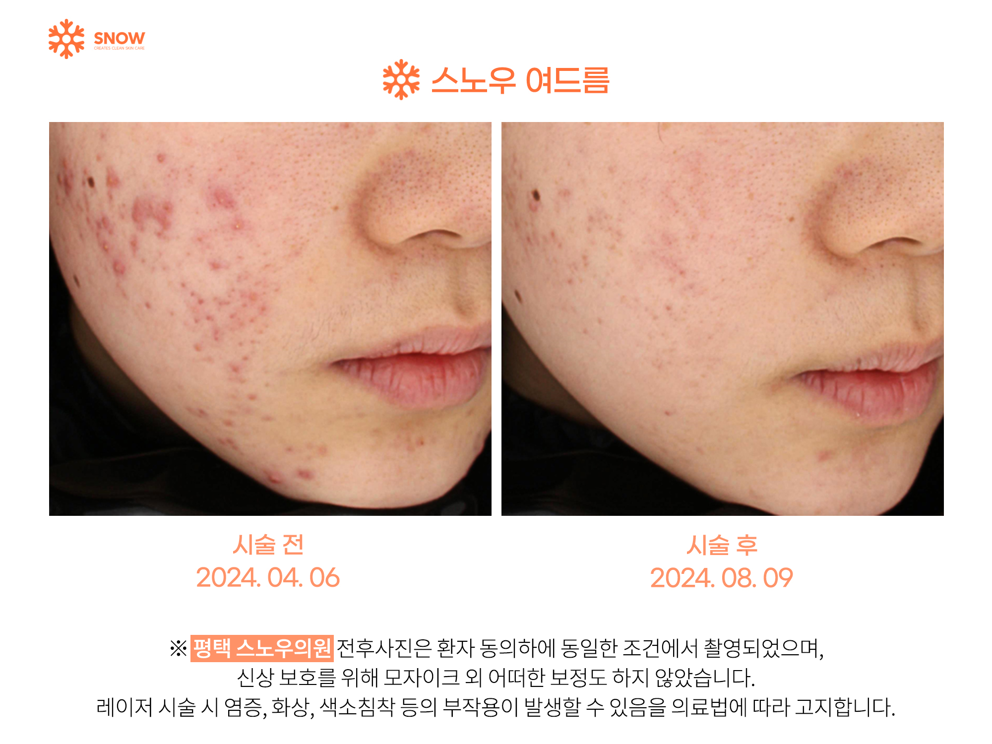 스노우의원 대표 이미지