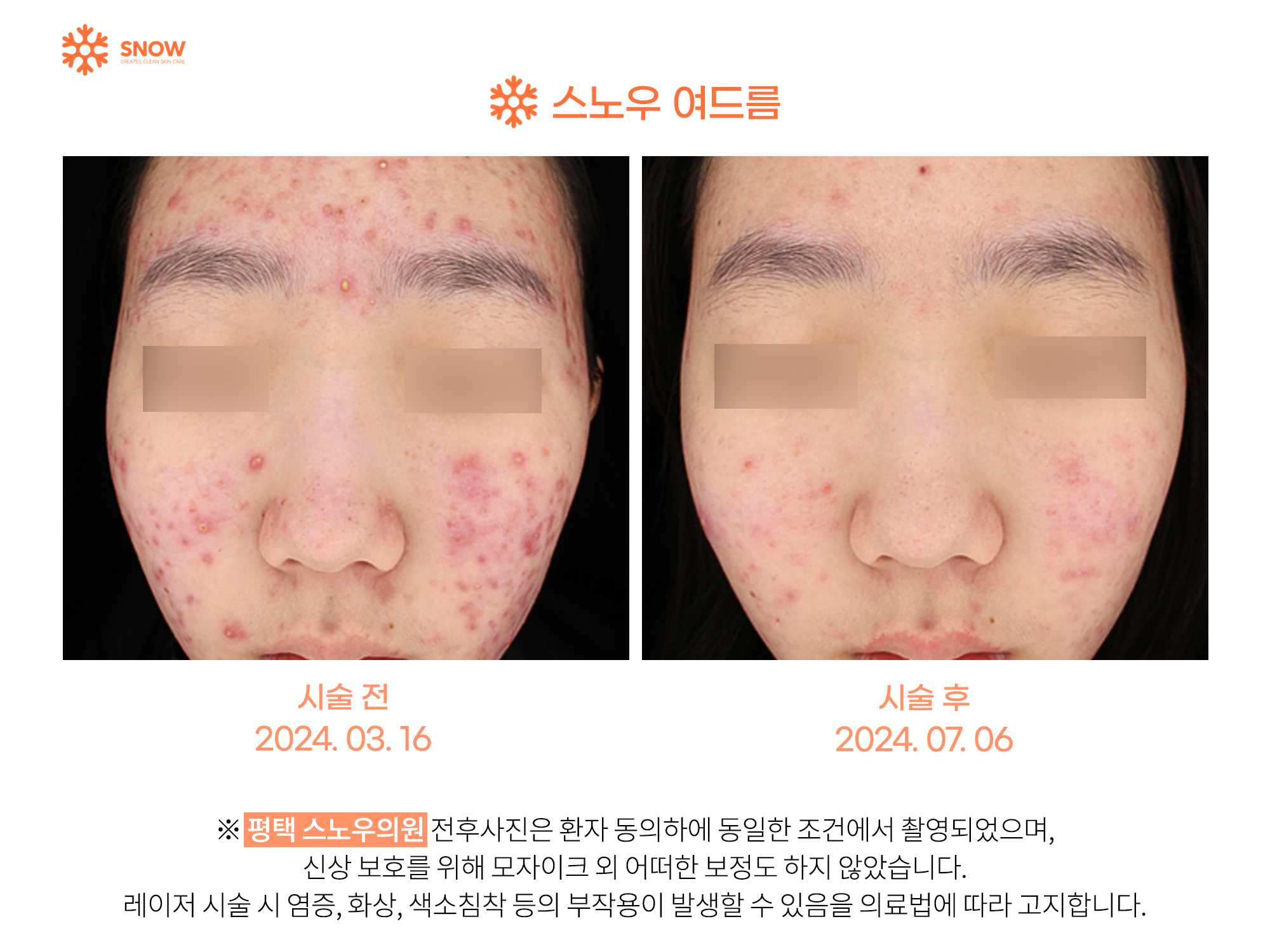 스노우의원 대표 이미지