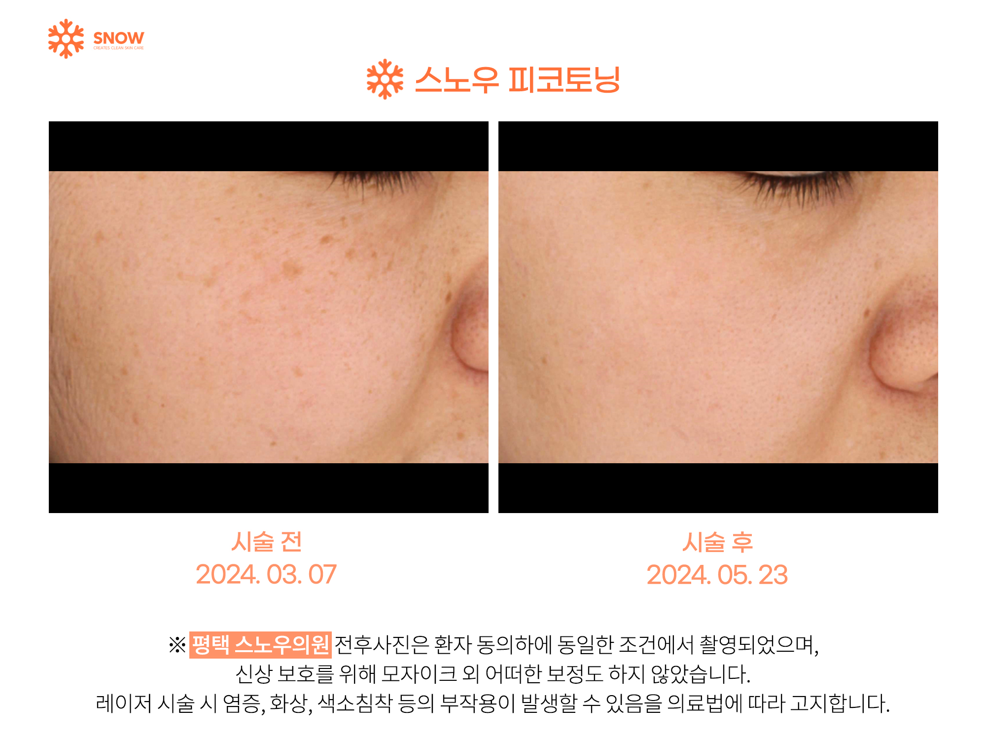 스노우의원 평택고덕점 대표 이미지