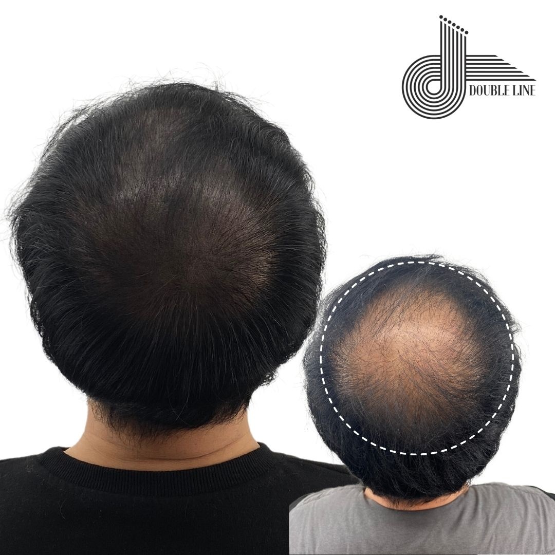 더블라인 천안점 대표 이미지