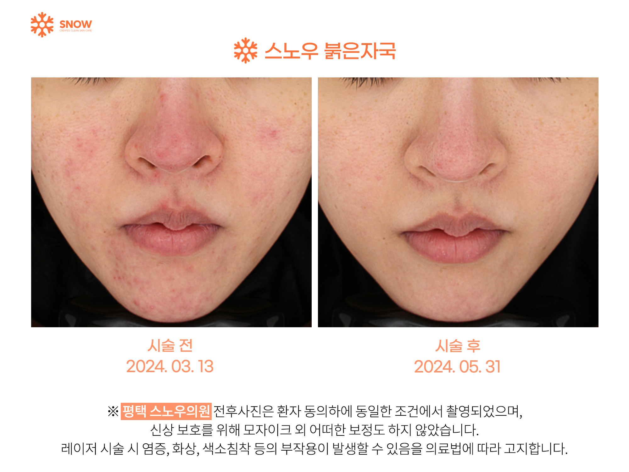 스노우의원 대표 이미지