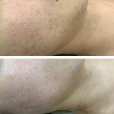 마이스킨테라피 수유점 대표 이미지