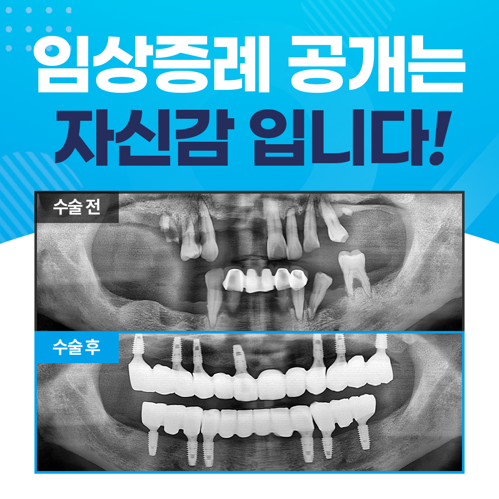 서울강남플란트치과의원 감곡점
