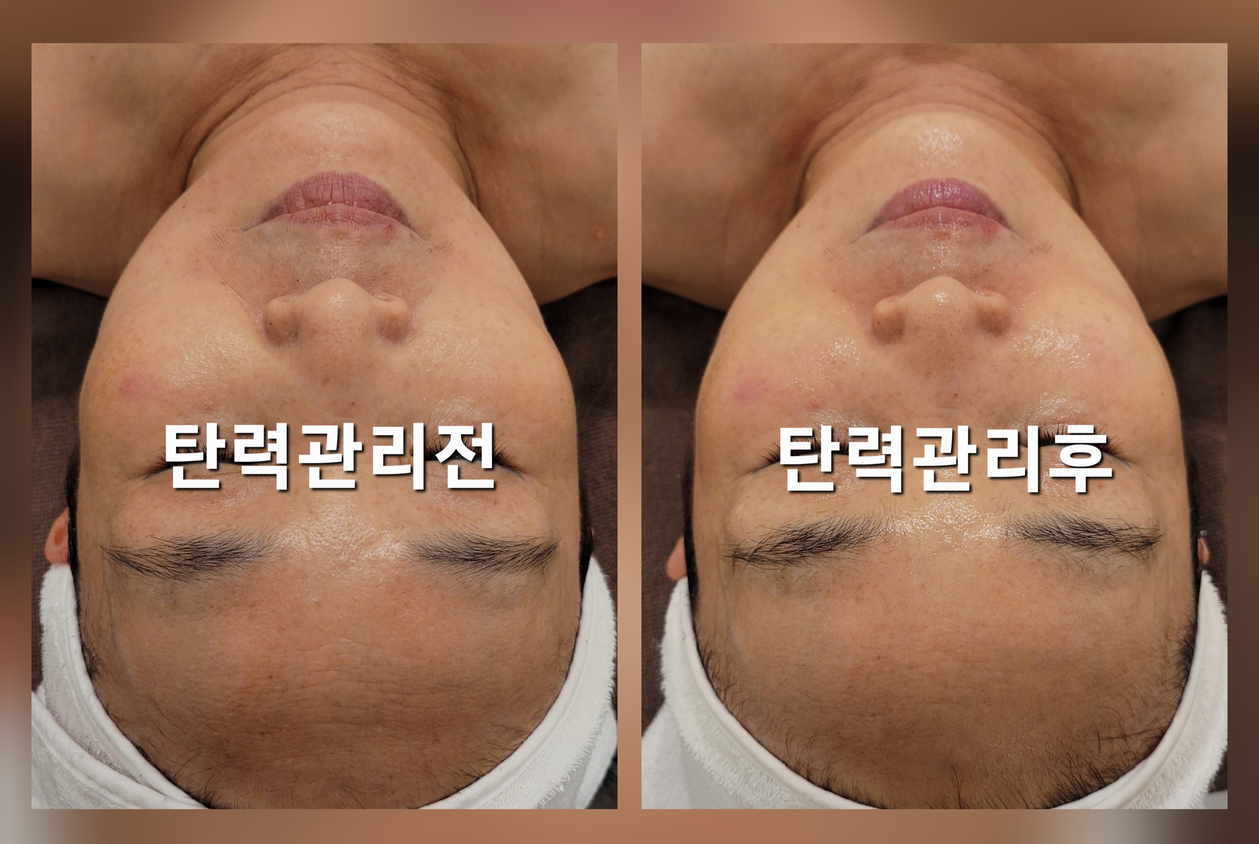 숲테라피 가산점 대표 이미지