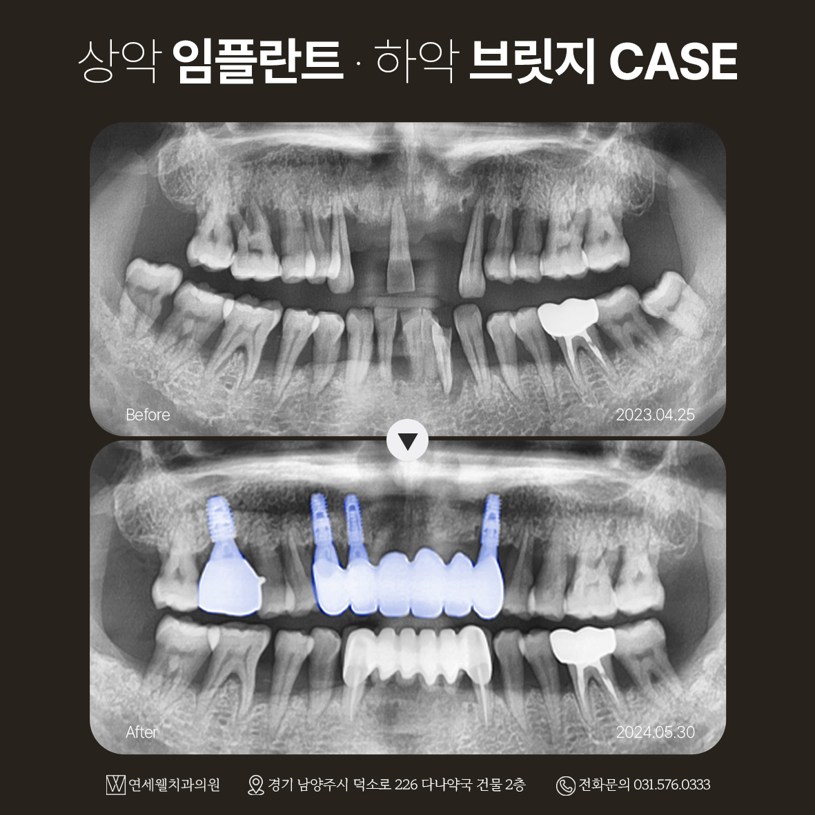 연세웰치과의원 대표 이미지