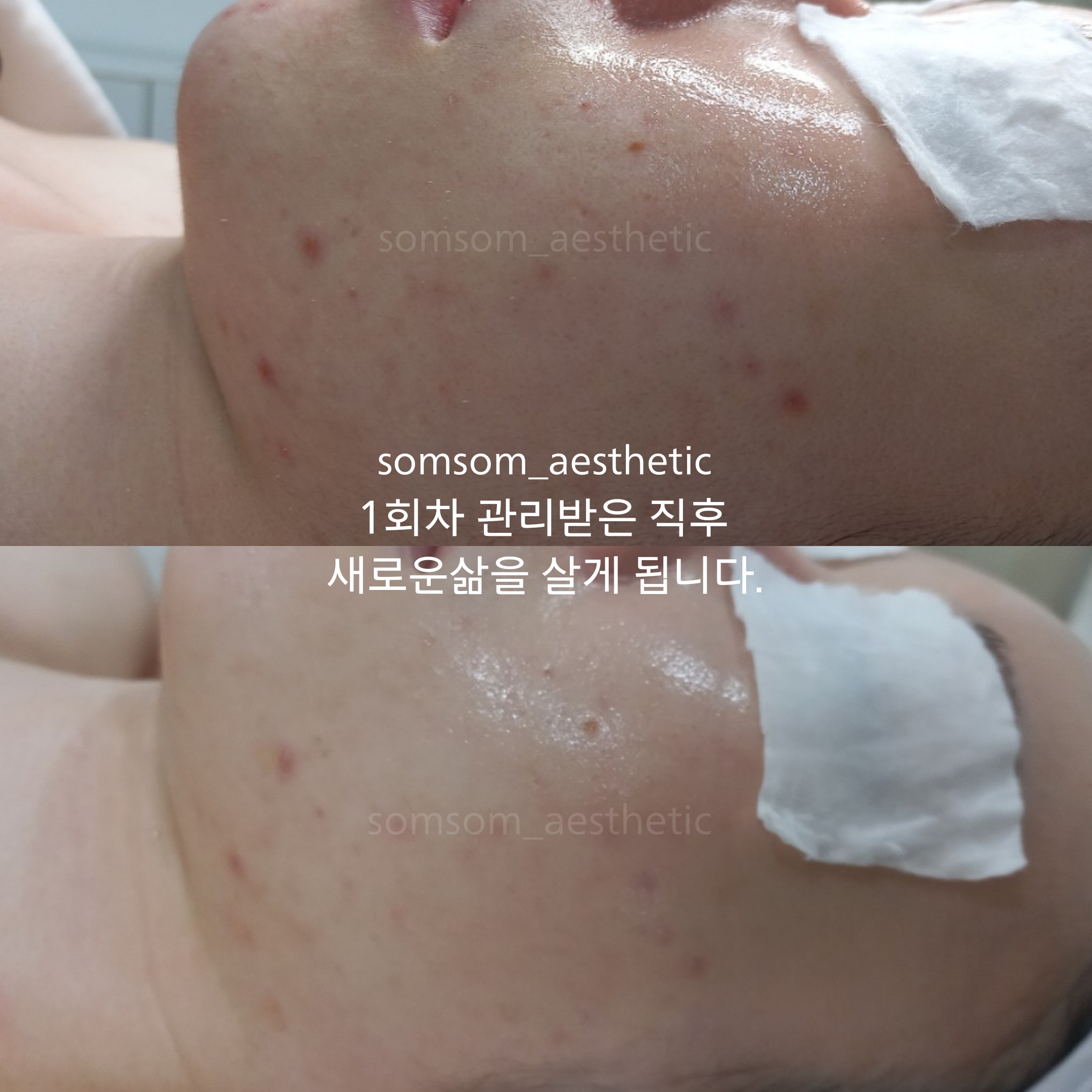 솜솜에스테틱 강남 선릉본점 대표 이미지