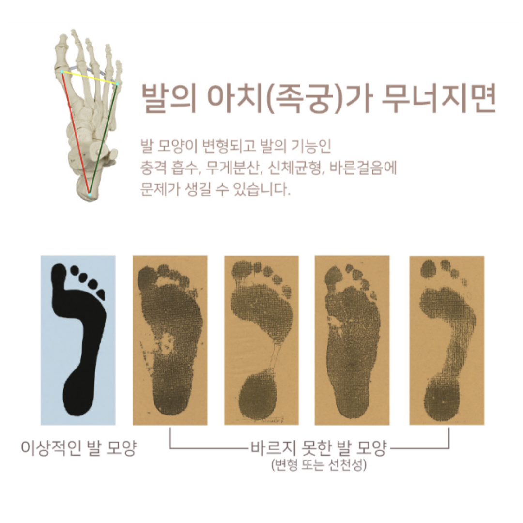 알즈너 옥합대리점