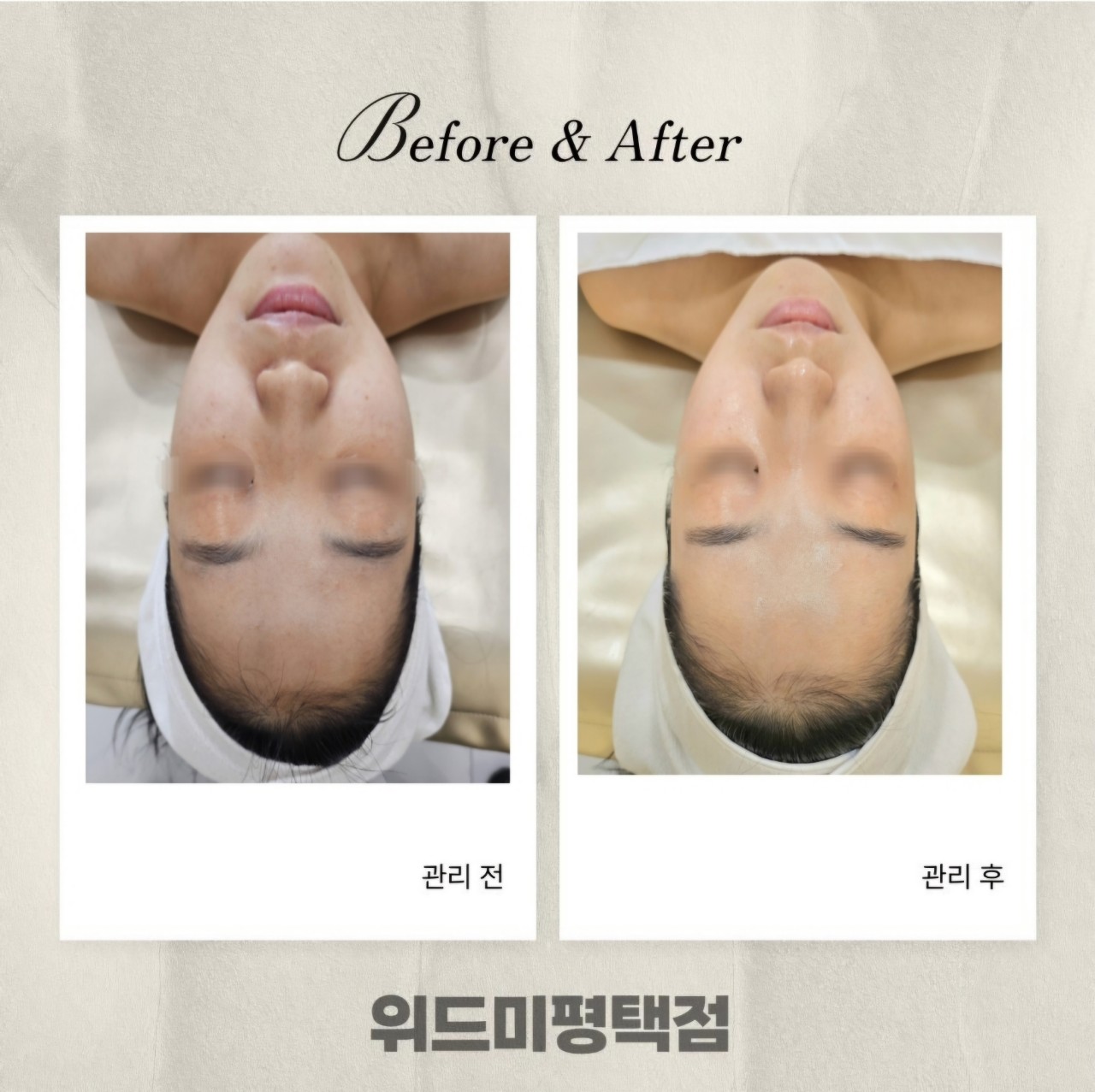 위드미 평택점