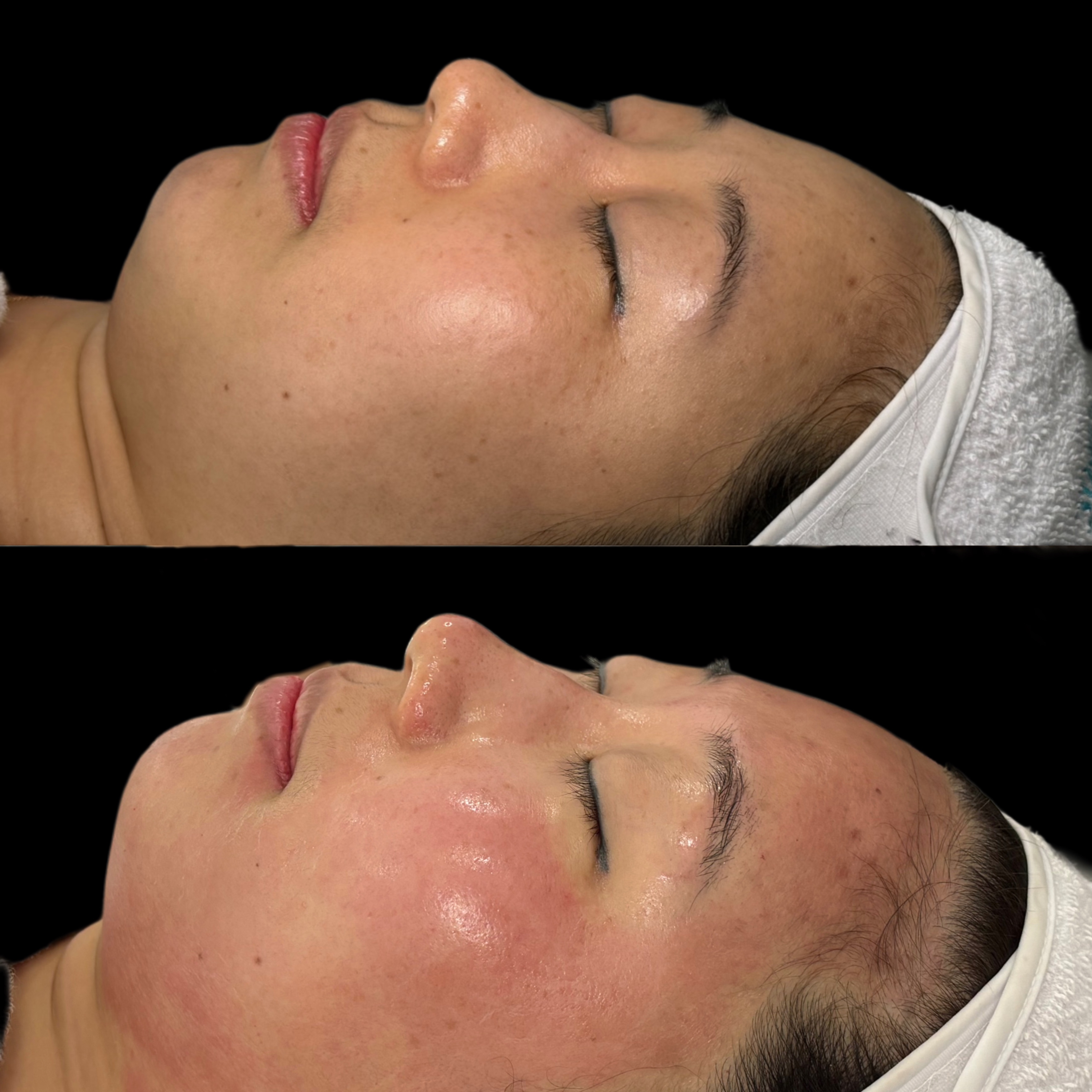 스킨신나라 대표 이미지