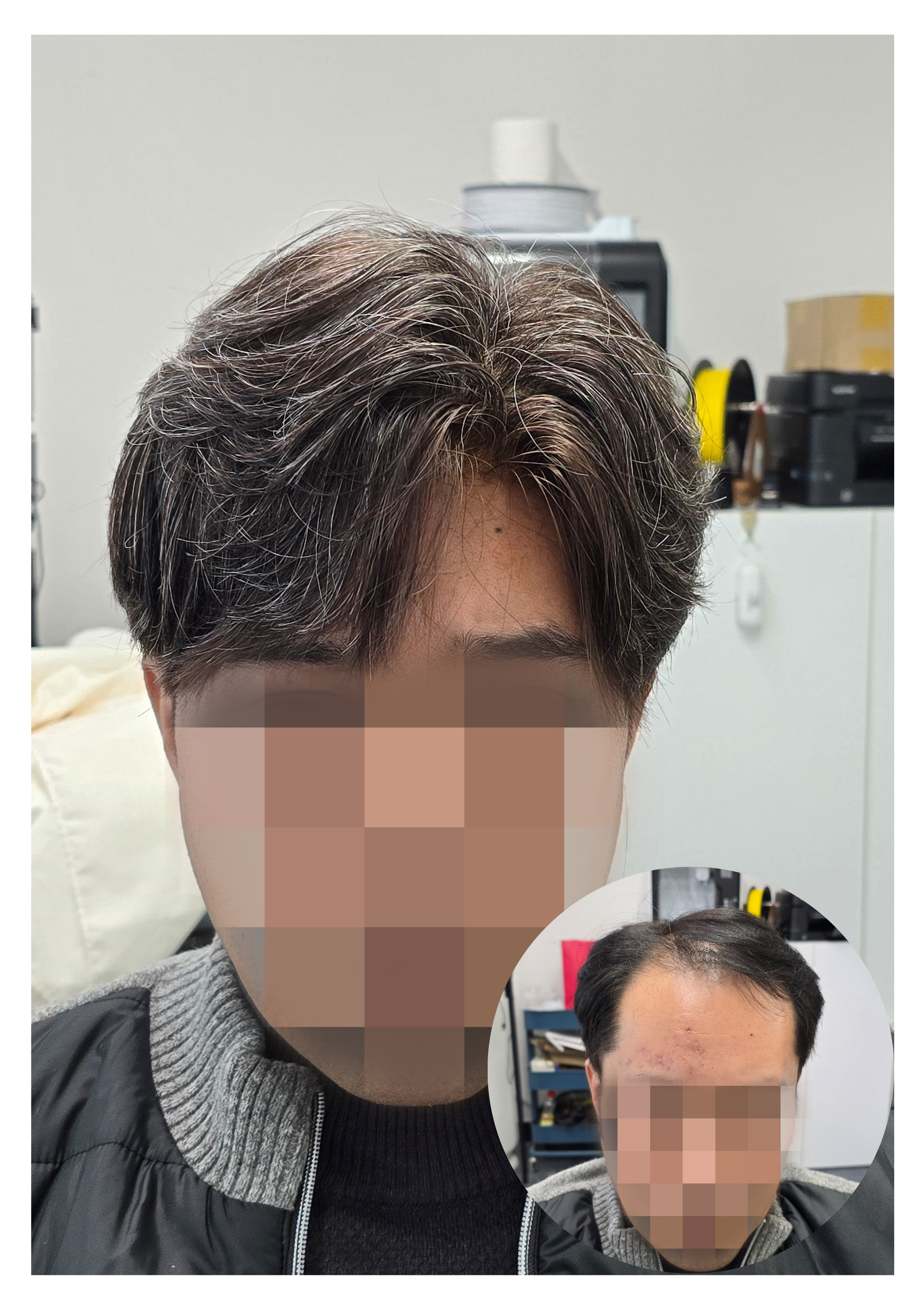 블랙스팟 대표 이미지