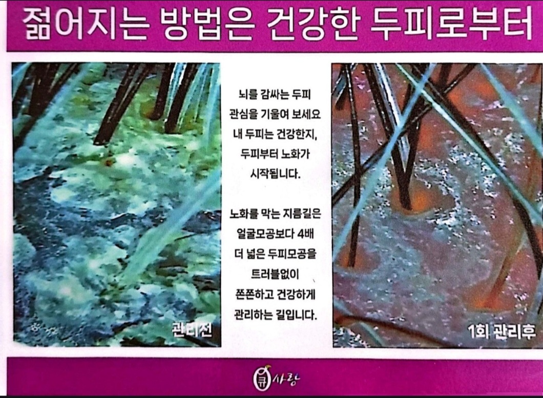 큐사랑 대표 이미지