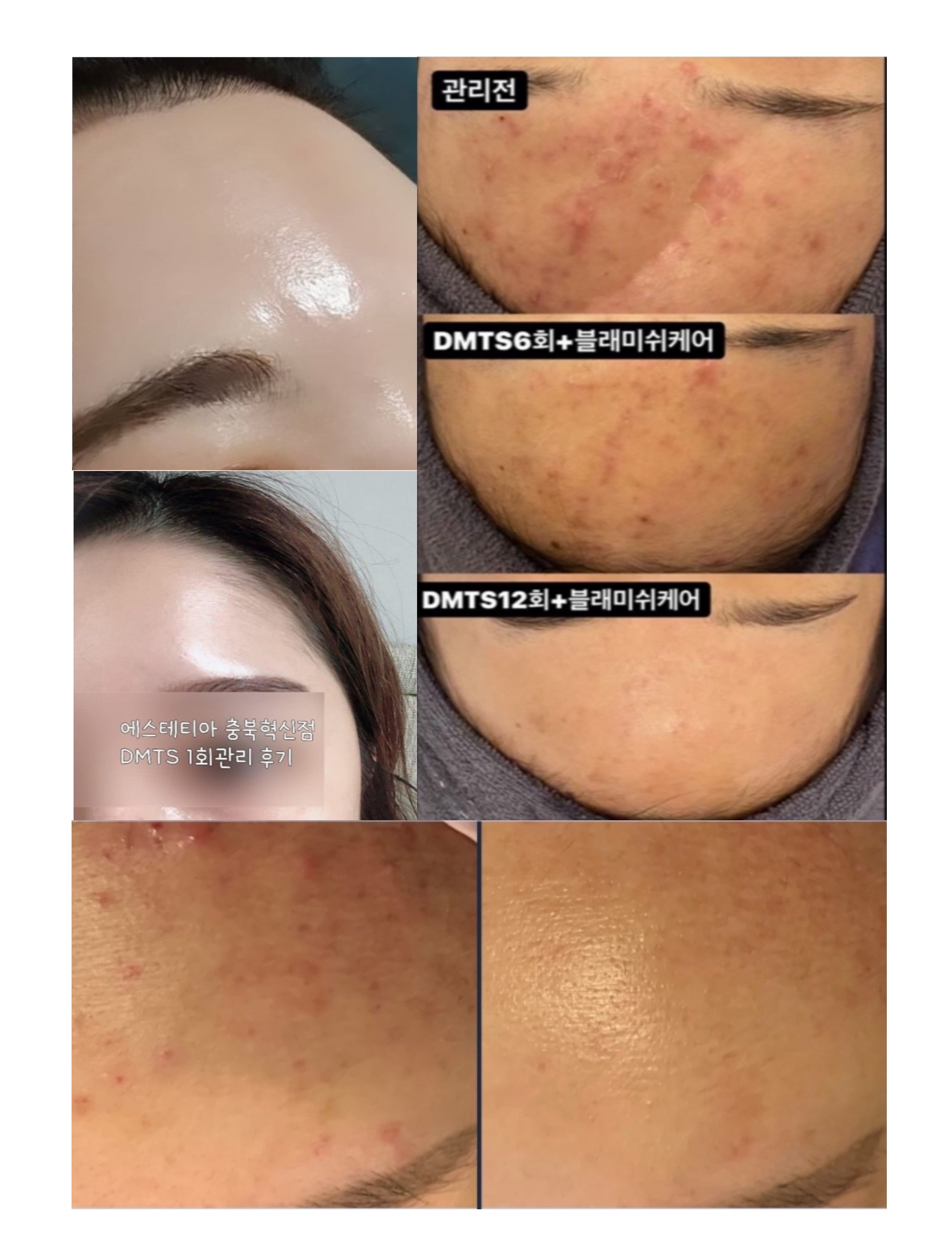 에스테티아 충북혁신1호점 photo 6