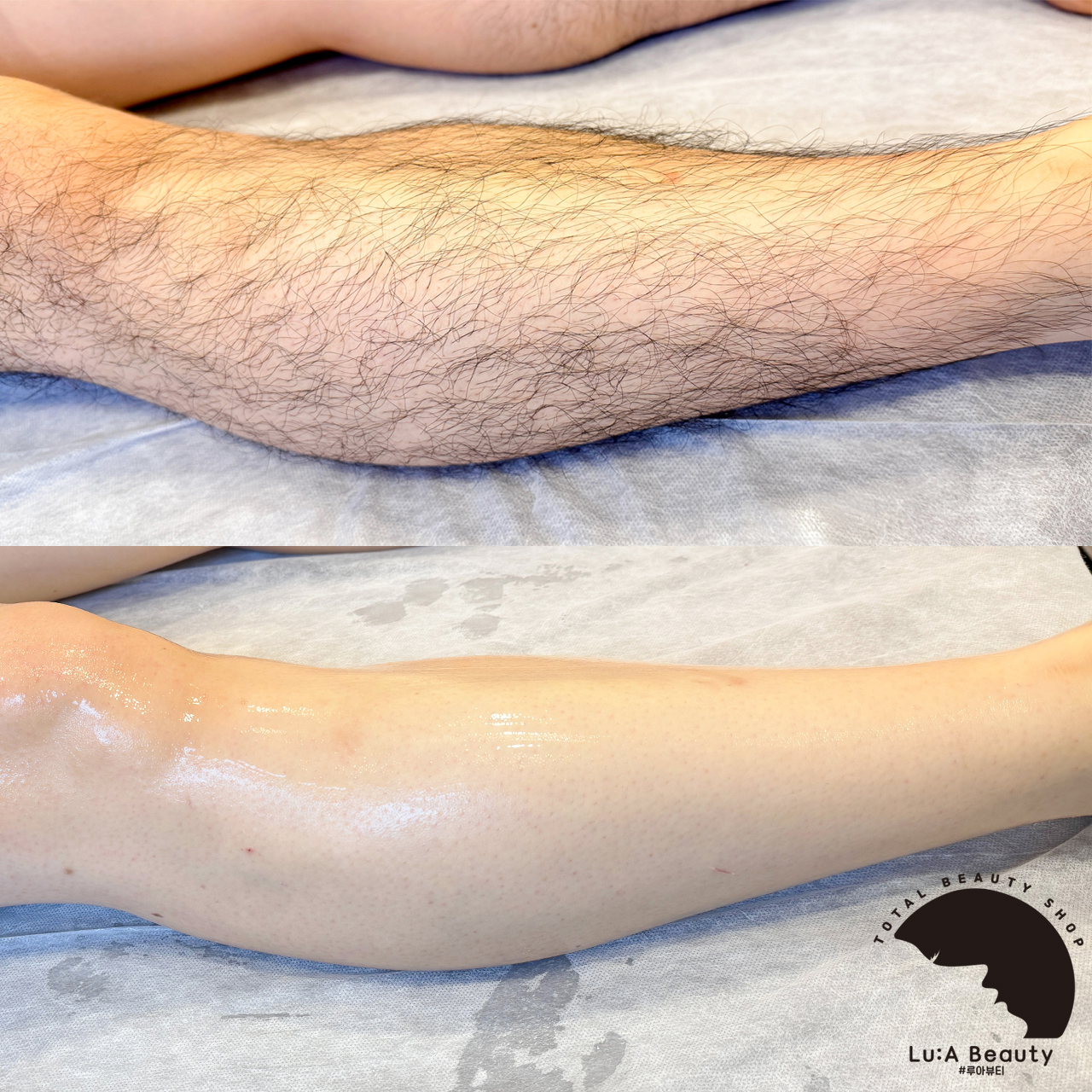 루아뷰티 대표 이미지