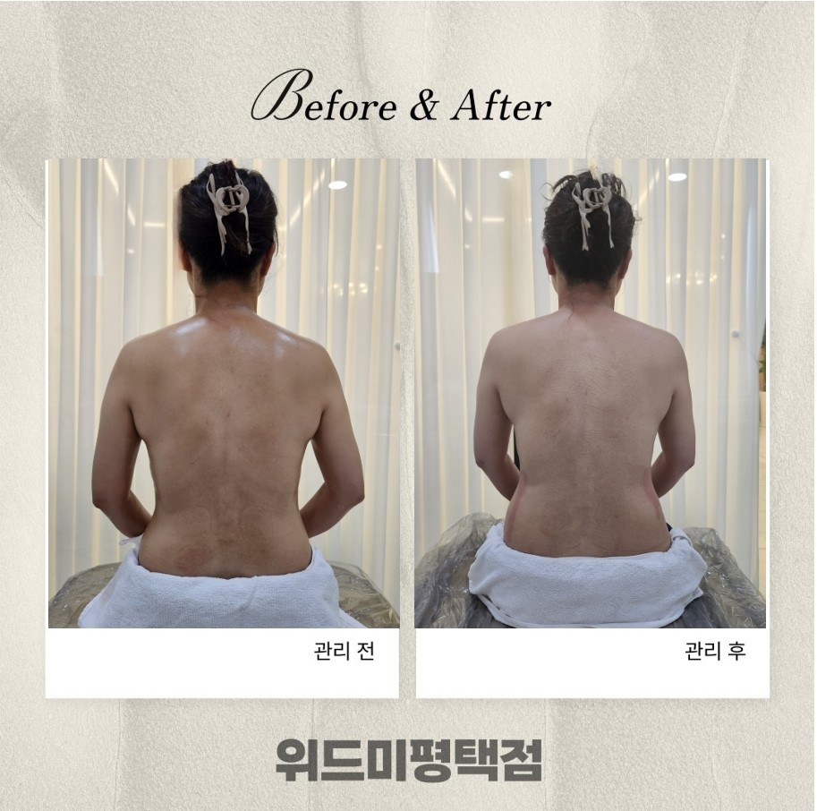 위드미 평택점