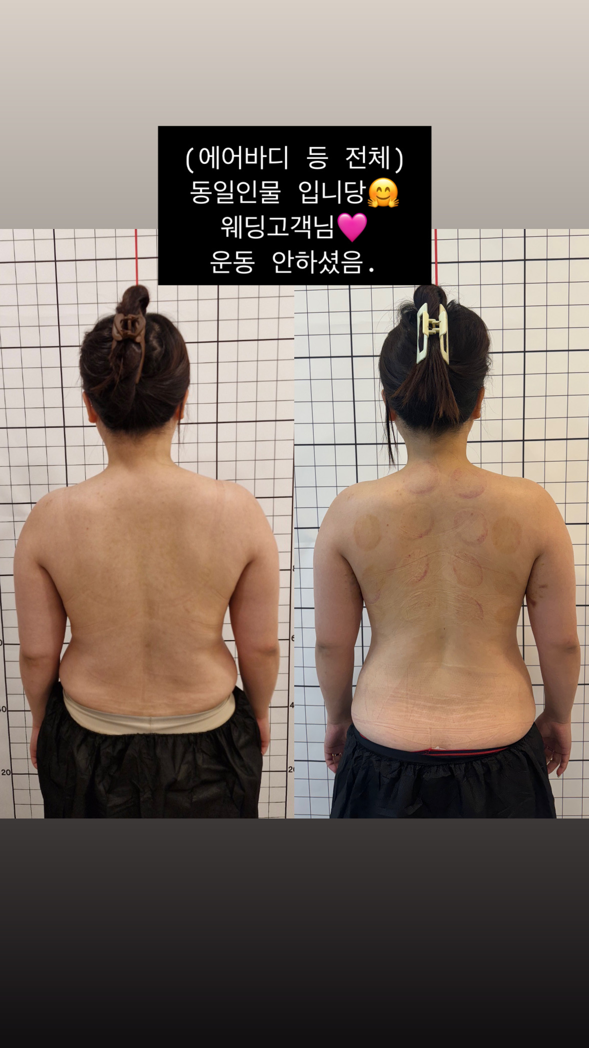 루아뷰티 & 에어바디 & 윤곽성형 리프팅 대표 이미지