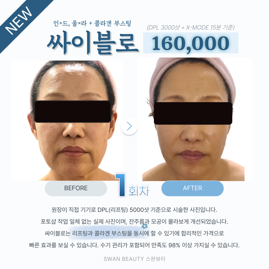 스완뷰티