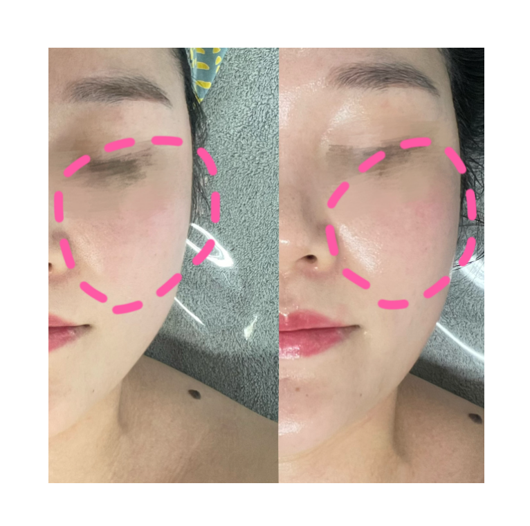 더맑은에스테틱