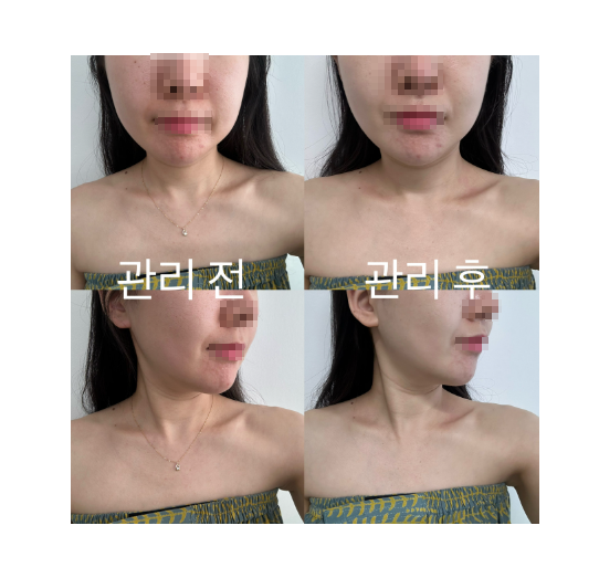더맑은에스테틱