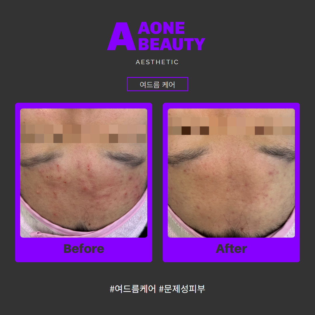에이원뷰티그룹 대구본점