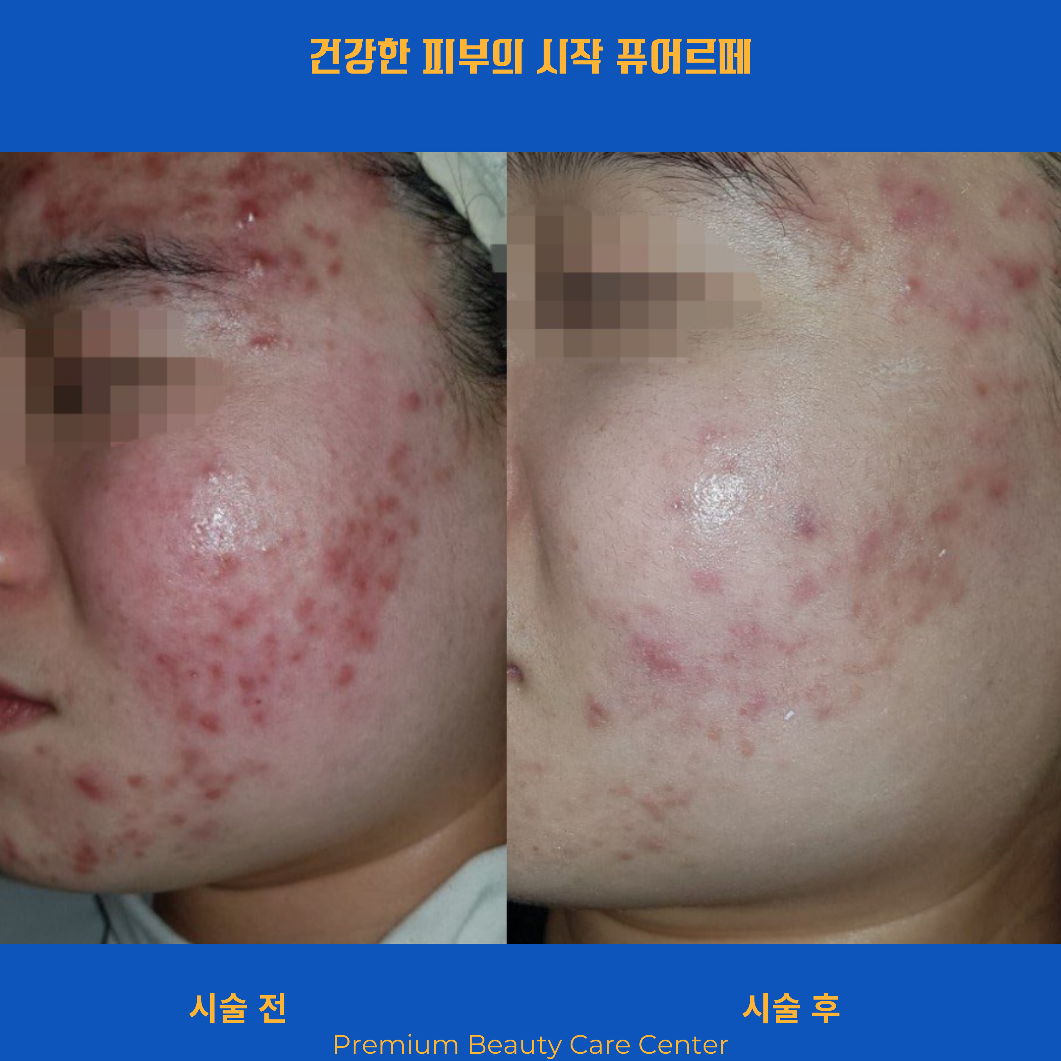 천안피부관리 퓨어르떼 대표 이미지