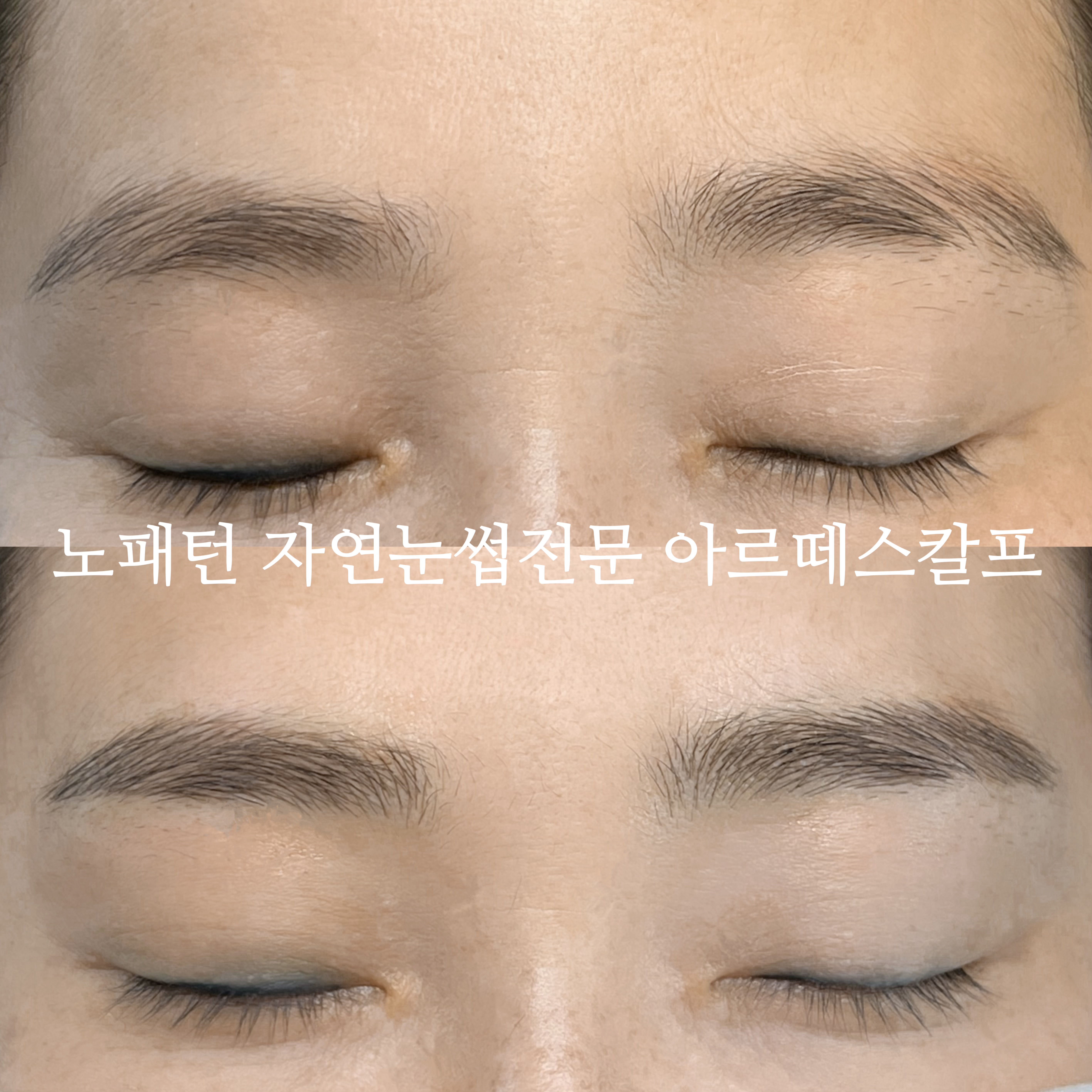 아르떼스칼프