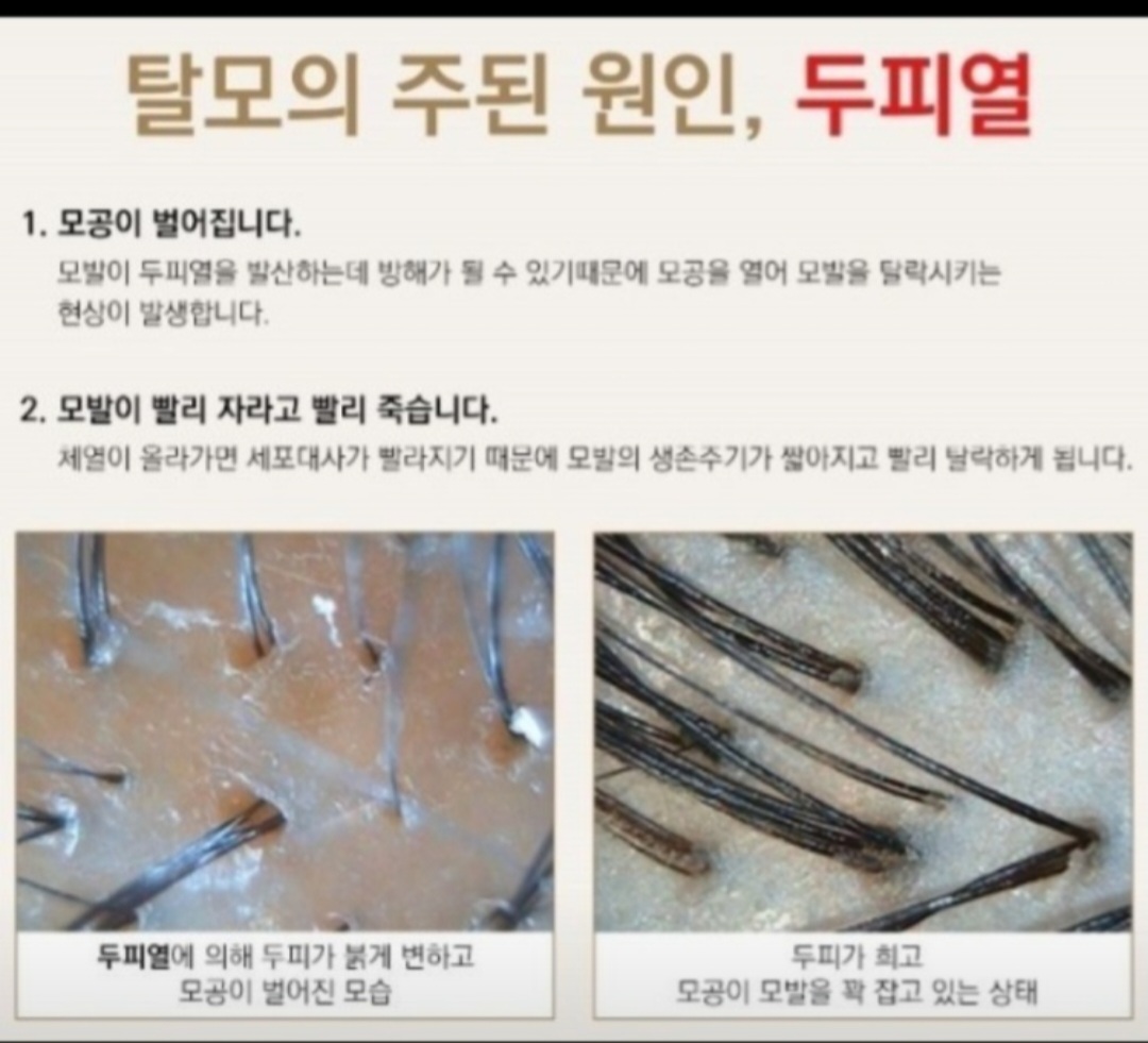 큐사랑 수지신봉점