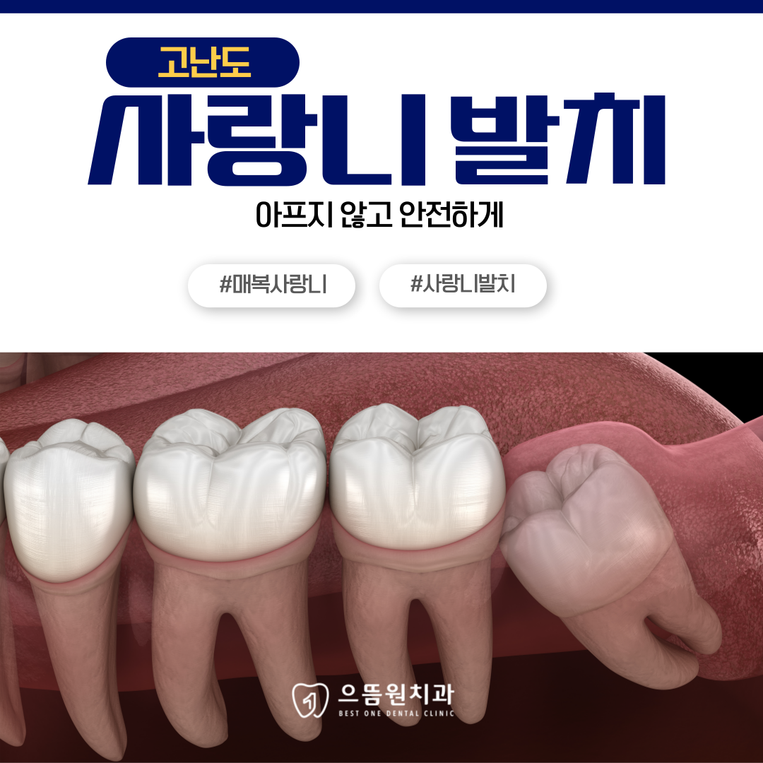 으뜸원치과의원 안양 대표 이미지
