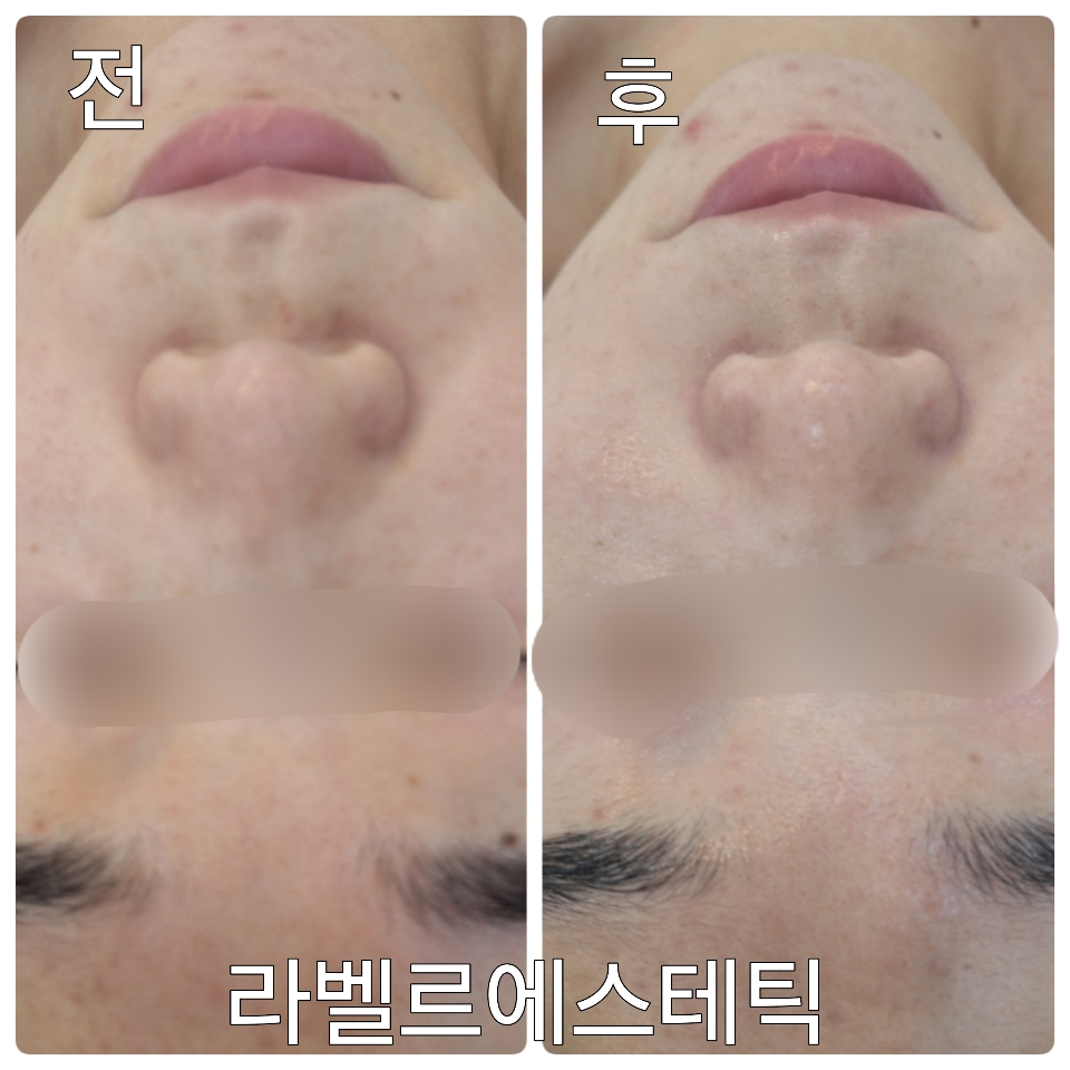 라벨르에스테틱