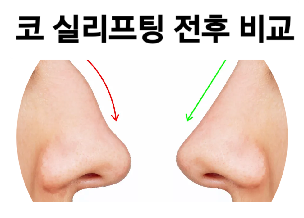 24까페거리의원