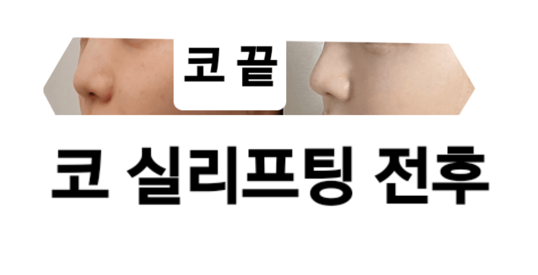 24까페거리의원