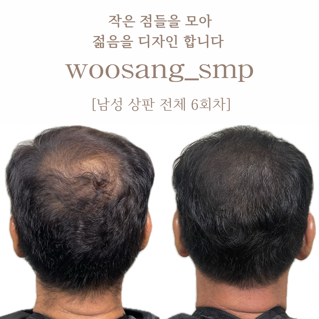 우상