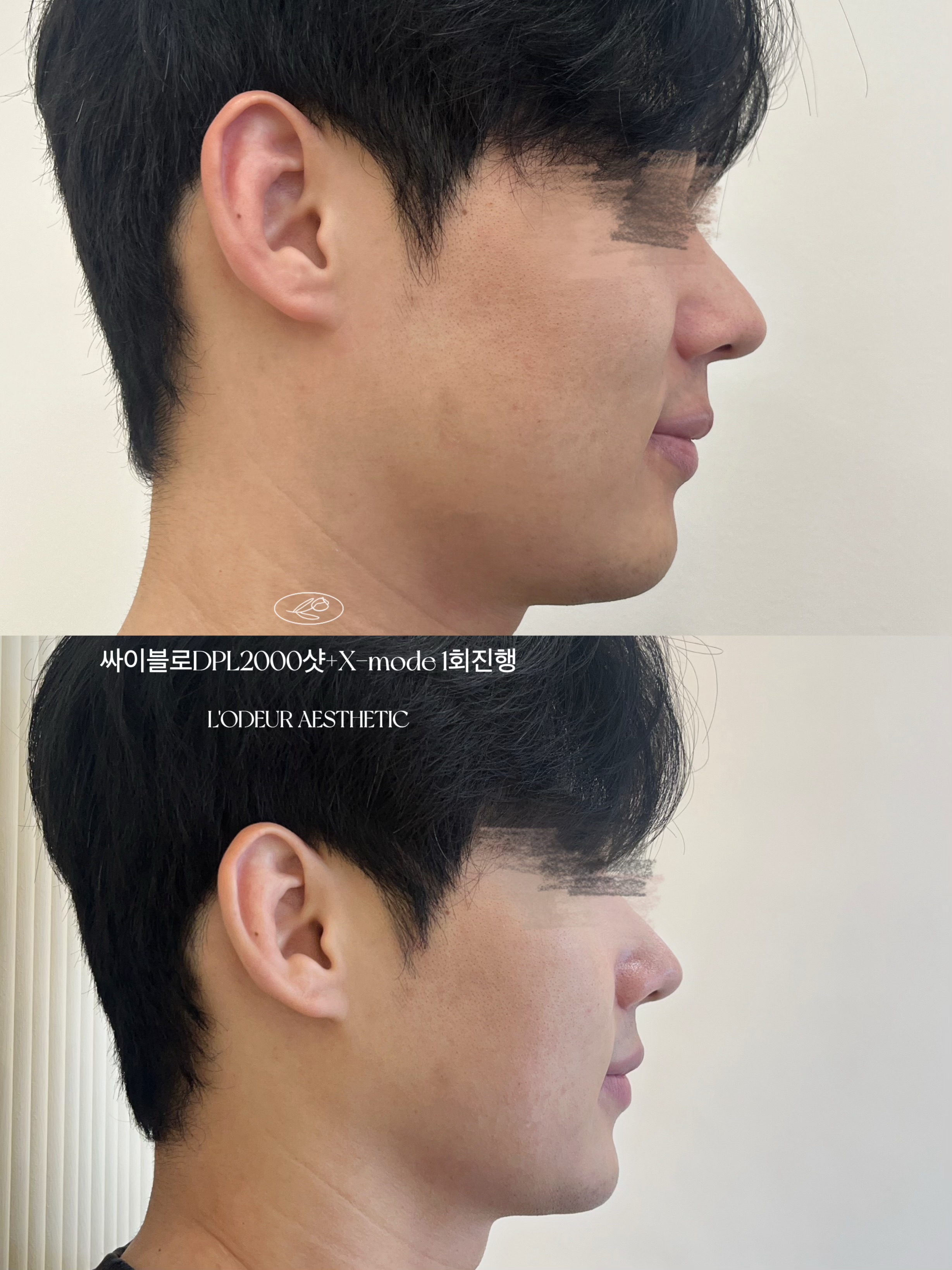로더에스테틱