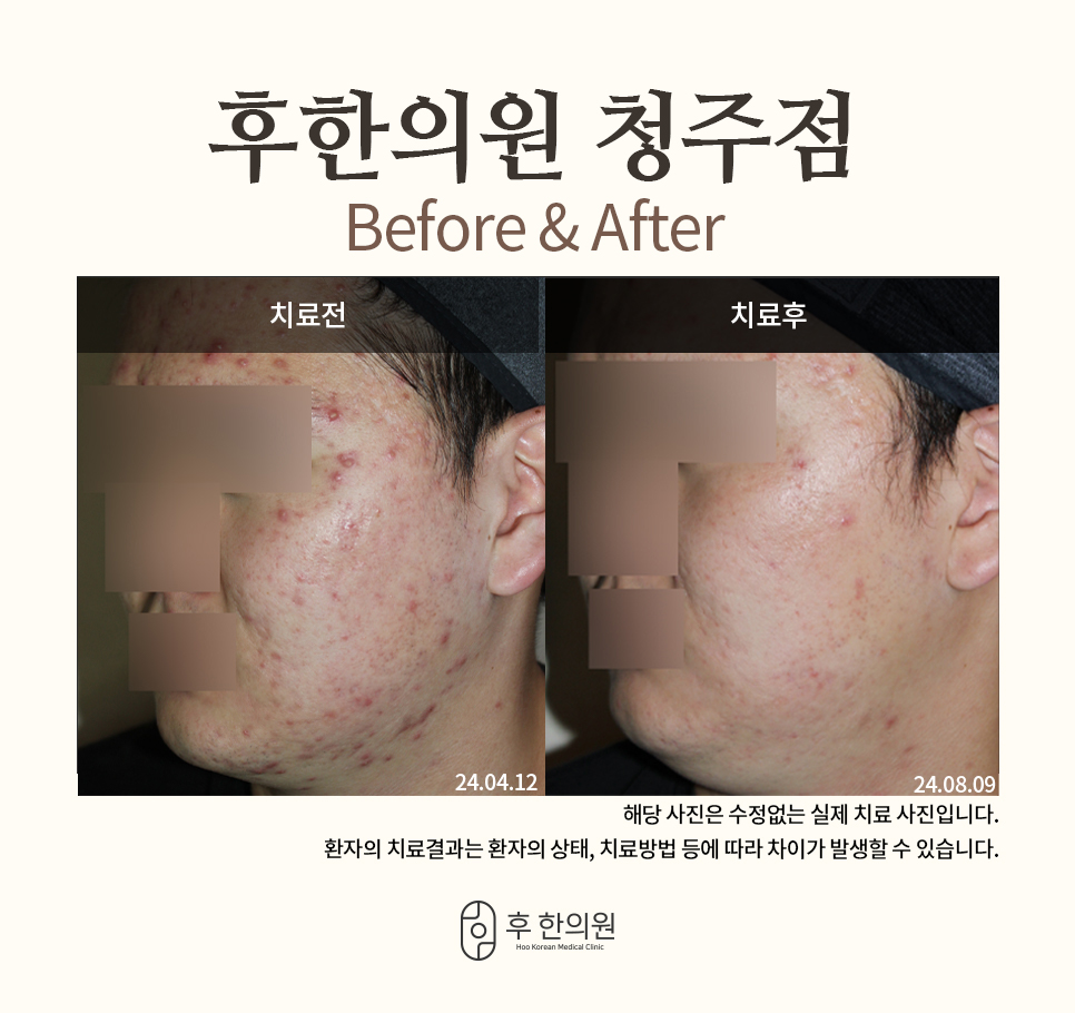 후한의원 청주점