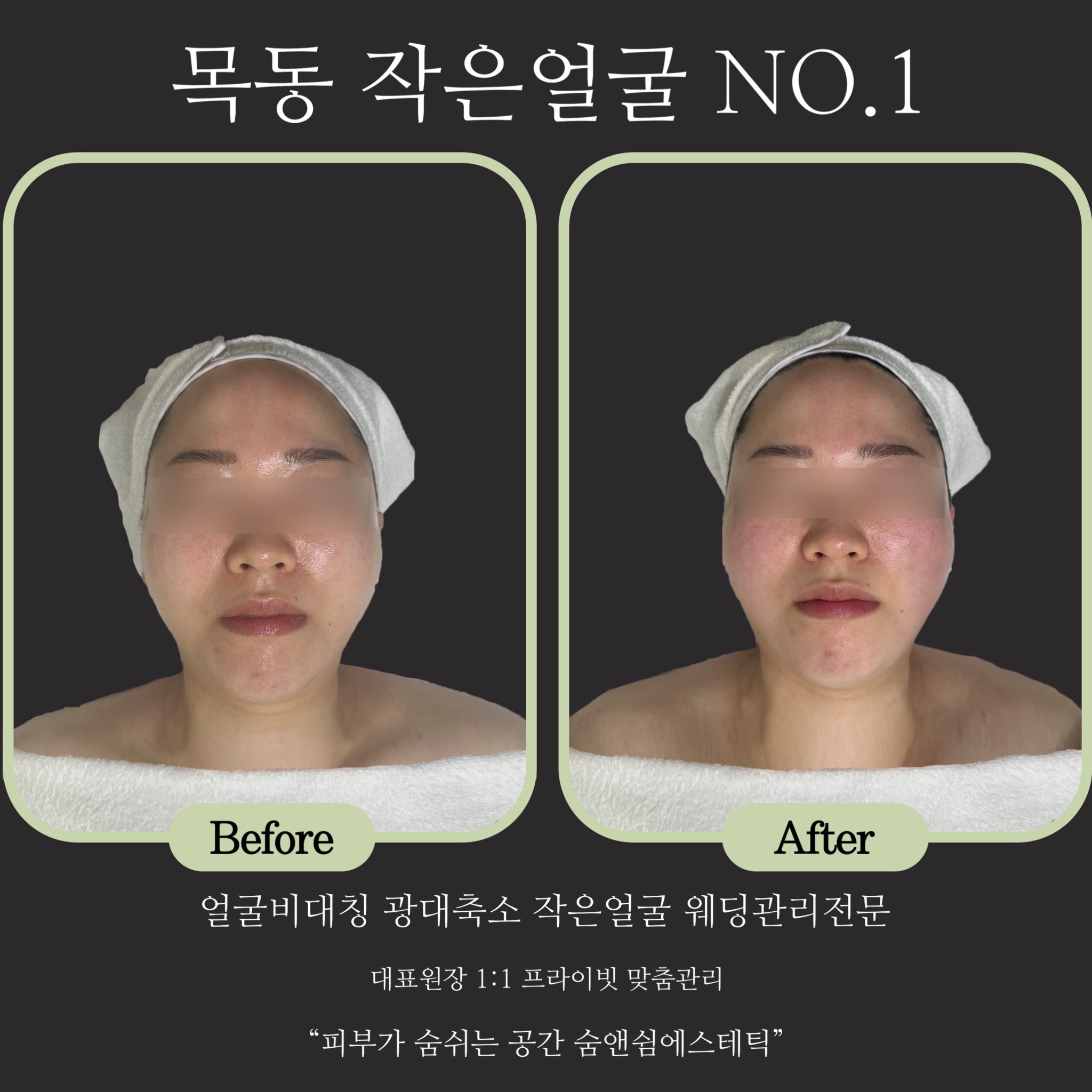 숨앤쉼에스테틱