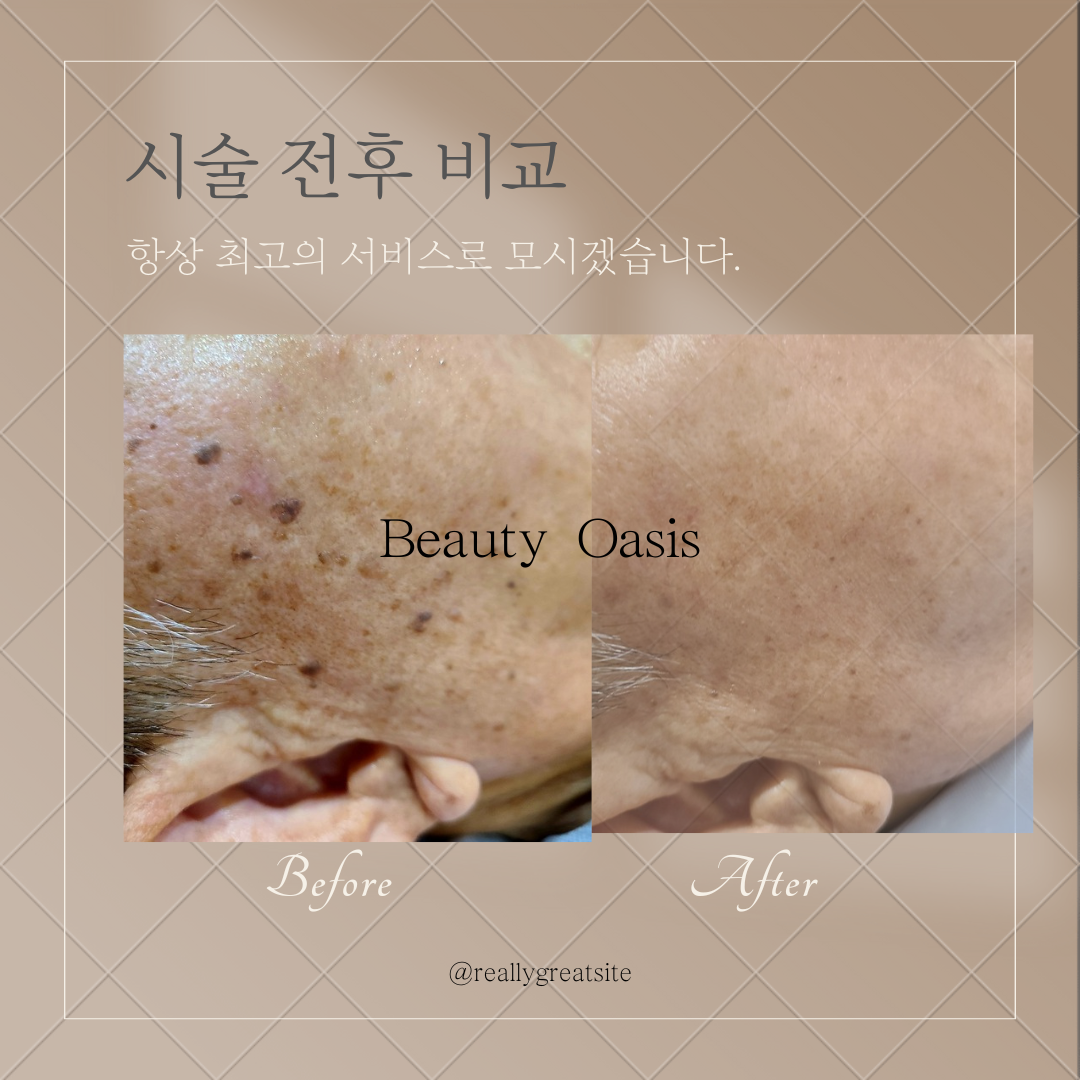 뷰티 오아시스