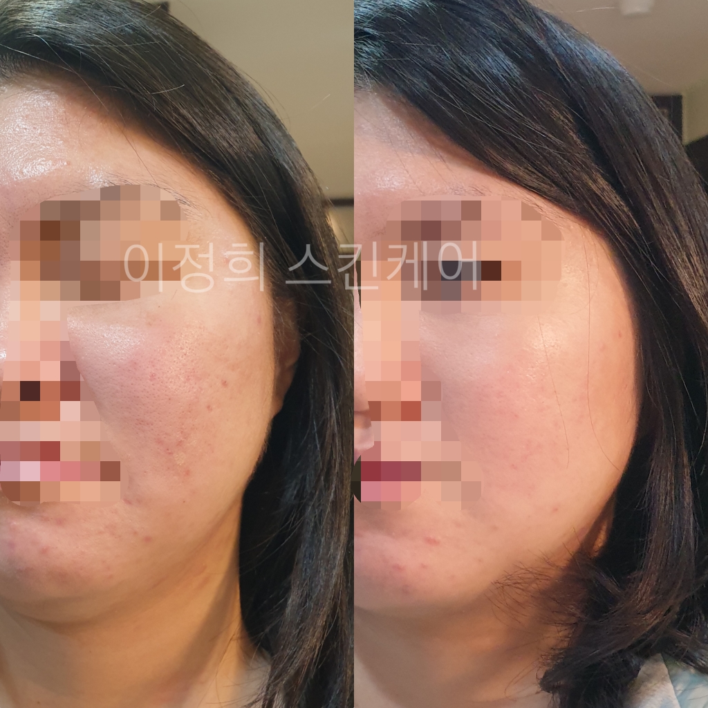 이정희스킨케어 대표 이미지