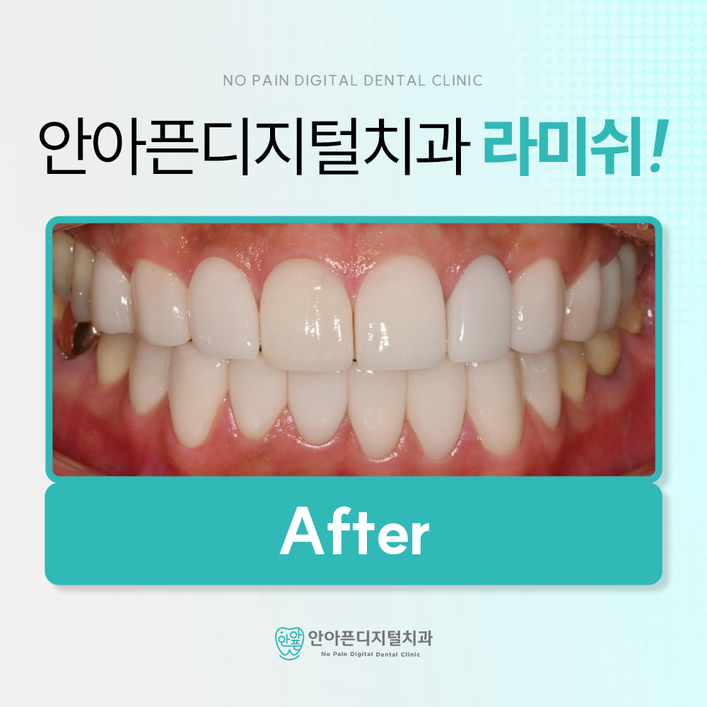 안아픈디지털치과의원 대표 이미지