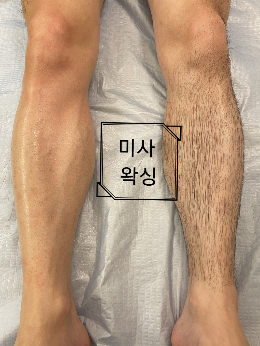 미사왁싱 대표 이미지