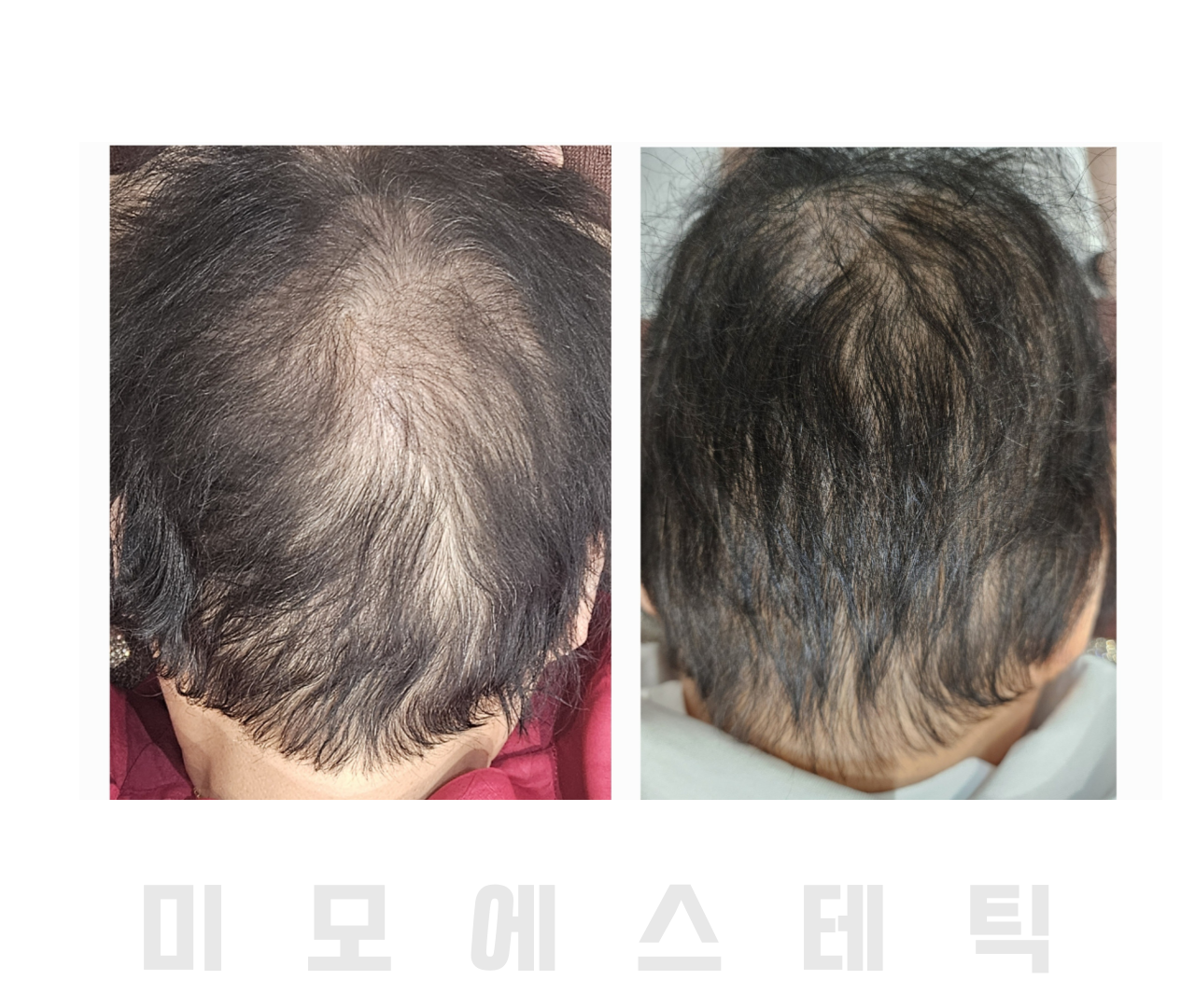 미모에스테틱 대표 이미지