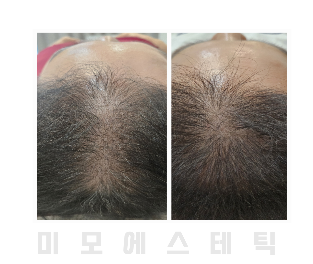 미모에스테틱 대표 이미지