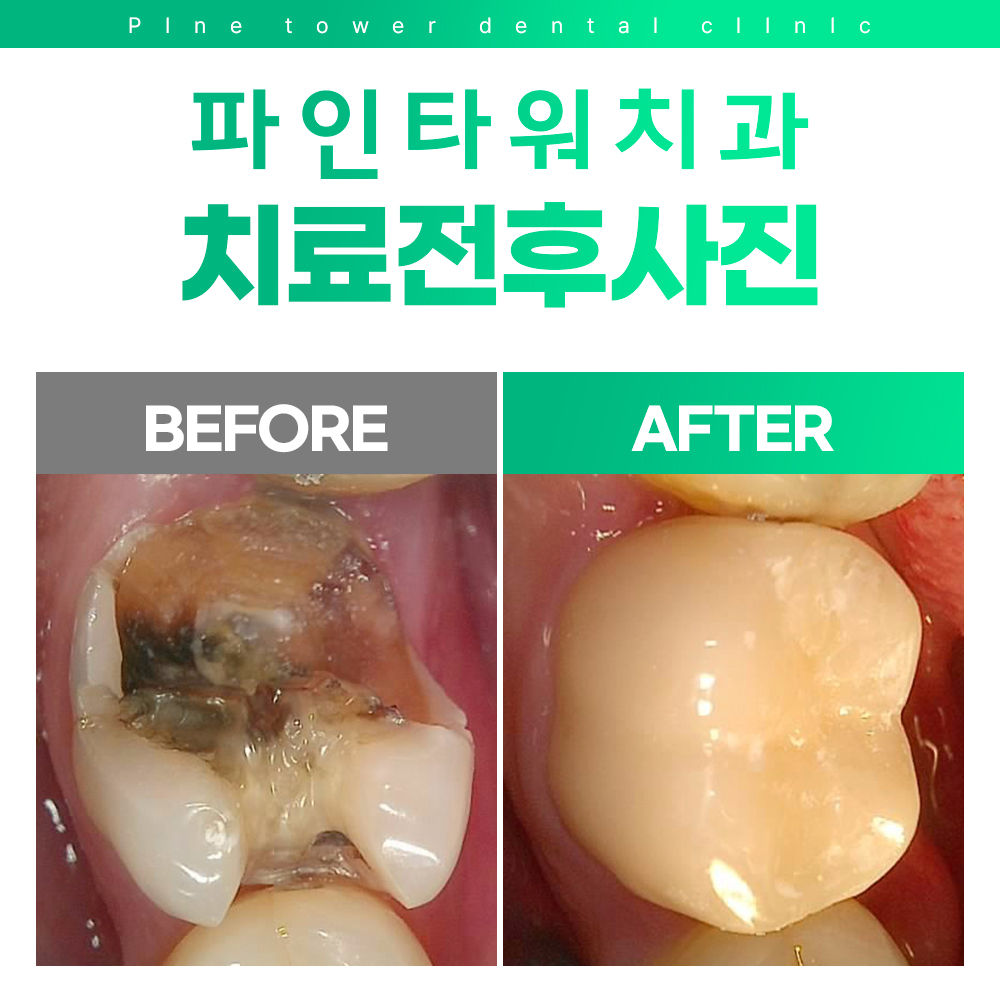 파인타워치과의원 대표 이미지