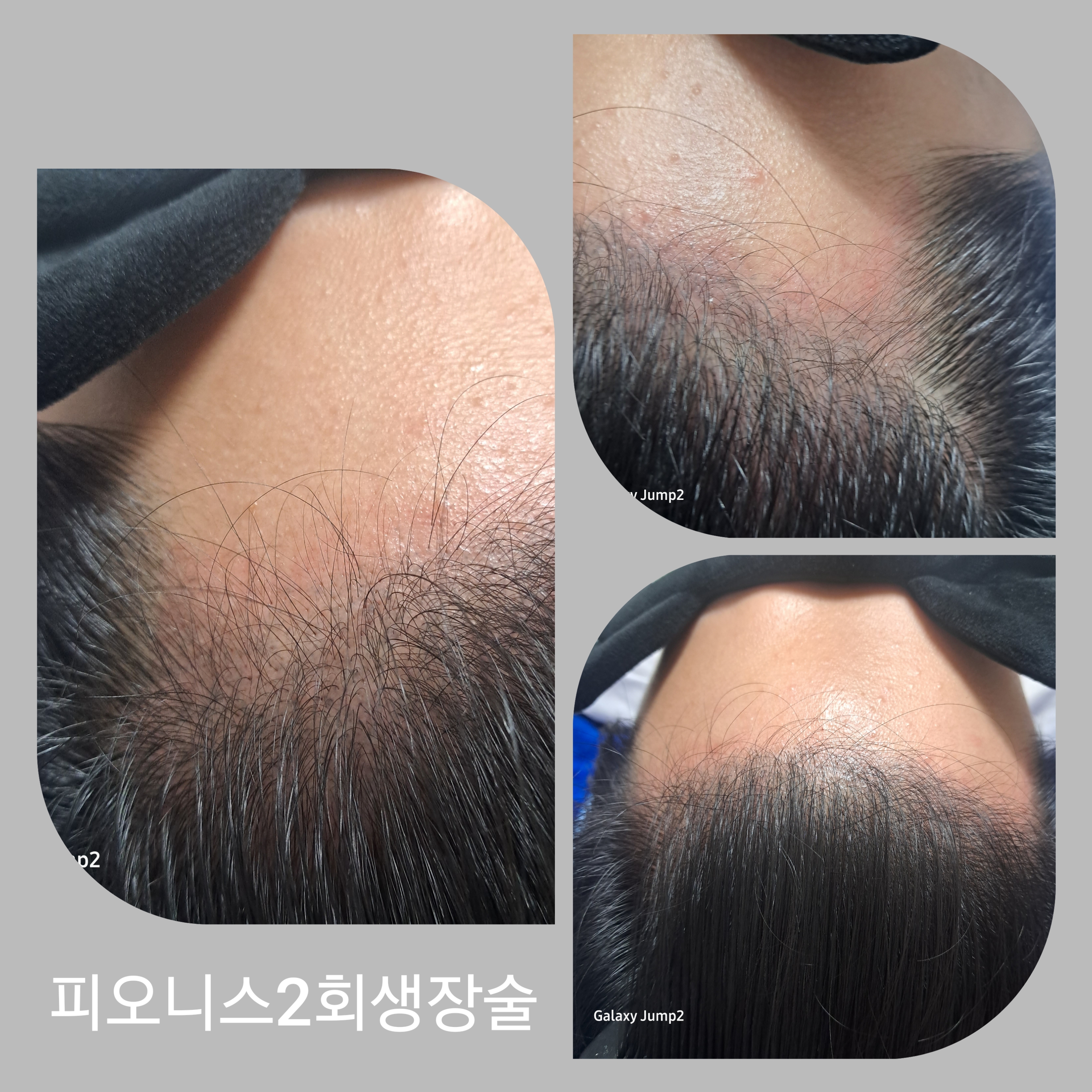 희헤어사랑