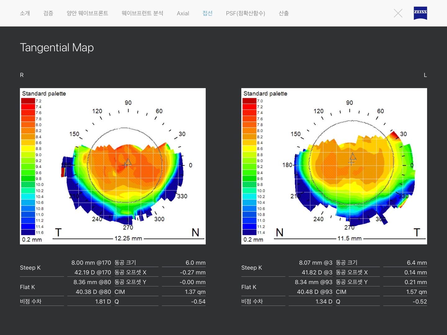 임팩트안경원 대표 이미지