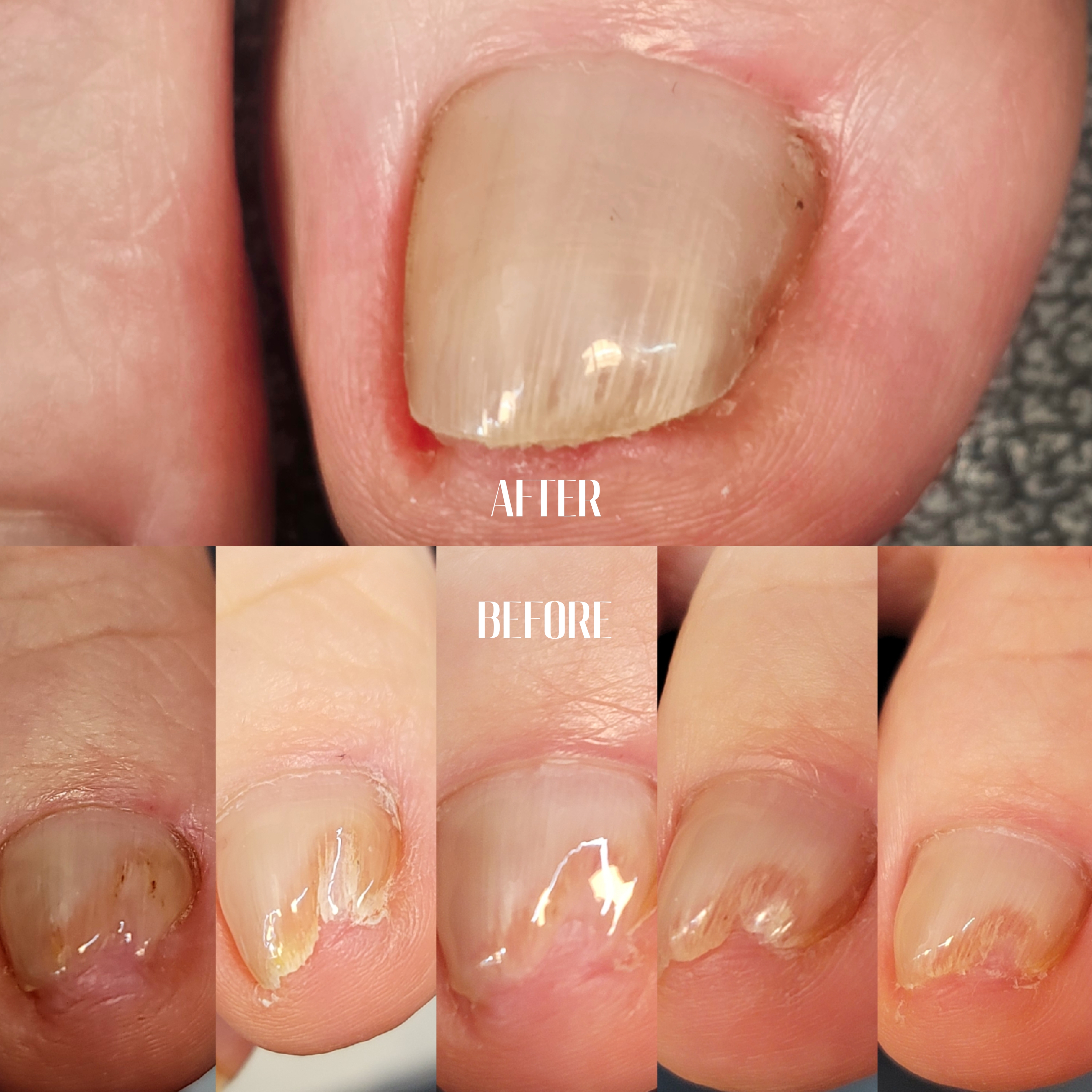 뷰티샤베트 대표 이미지