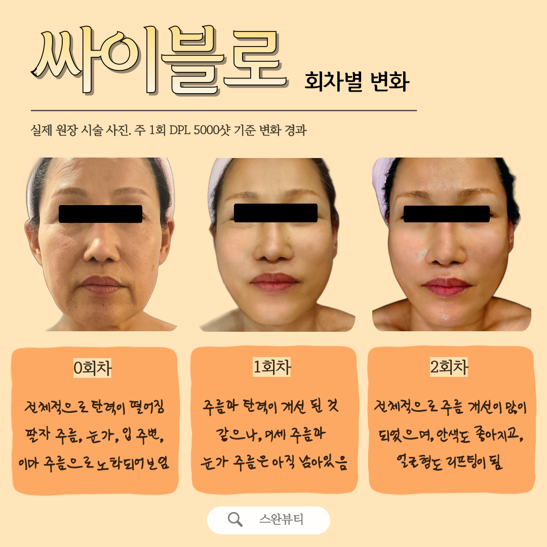 스완뷰티