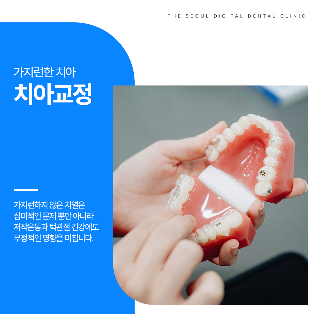 더서울디지털치과의원 대표 이미지