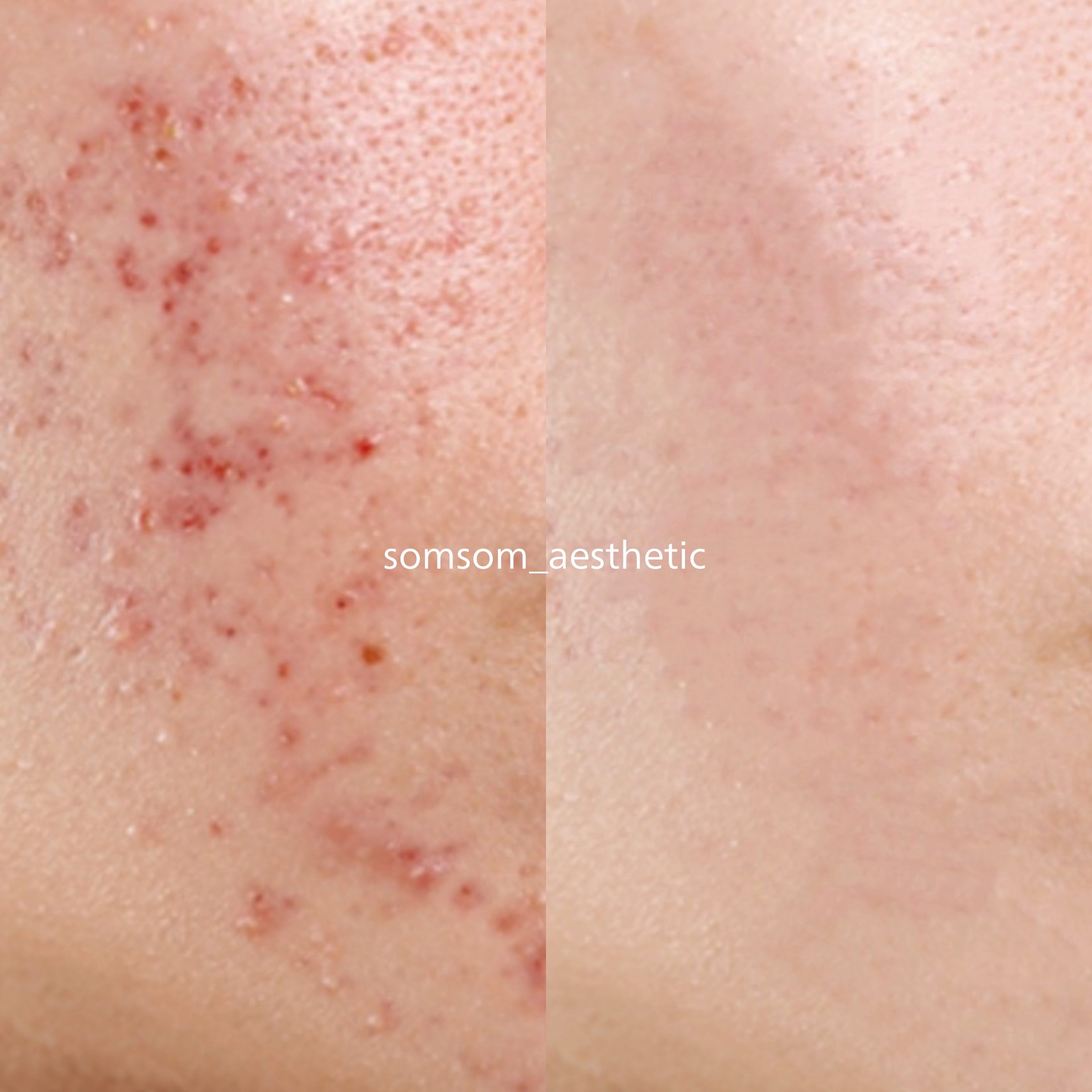 솜솜에스테틱 강남 선릉본점 대표 이미지